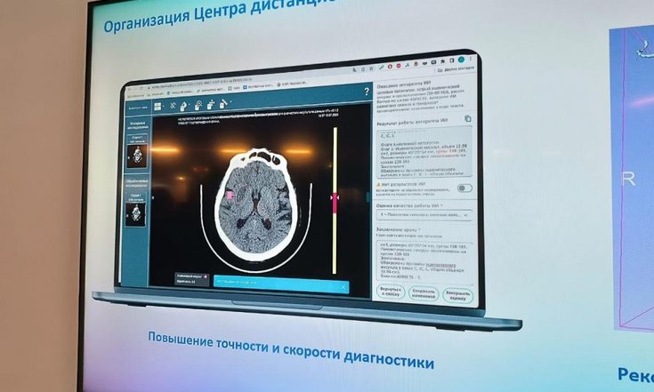 В Тюмени разрабатывают алгоритм для автоматического определения степени тяжести поражения коронарных сосудов